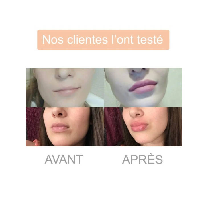 Repulpeur à Lèvres